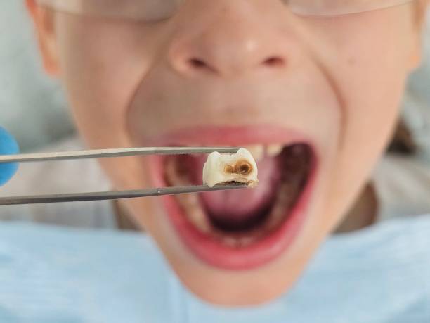 Best Teeth Whitening  in Roeland Park, KS